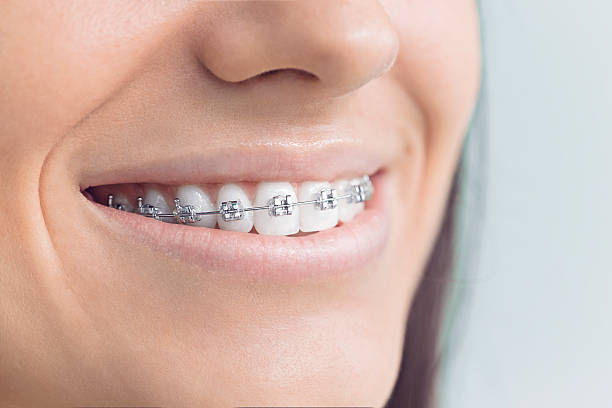 Best Root Canal Treatment  in Scott, LA